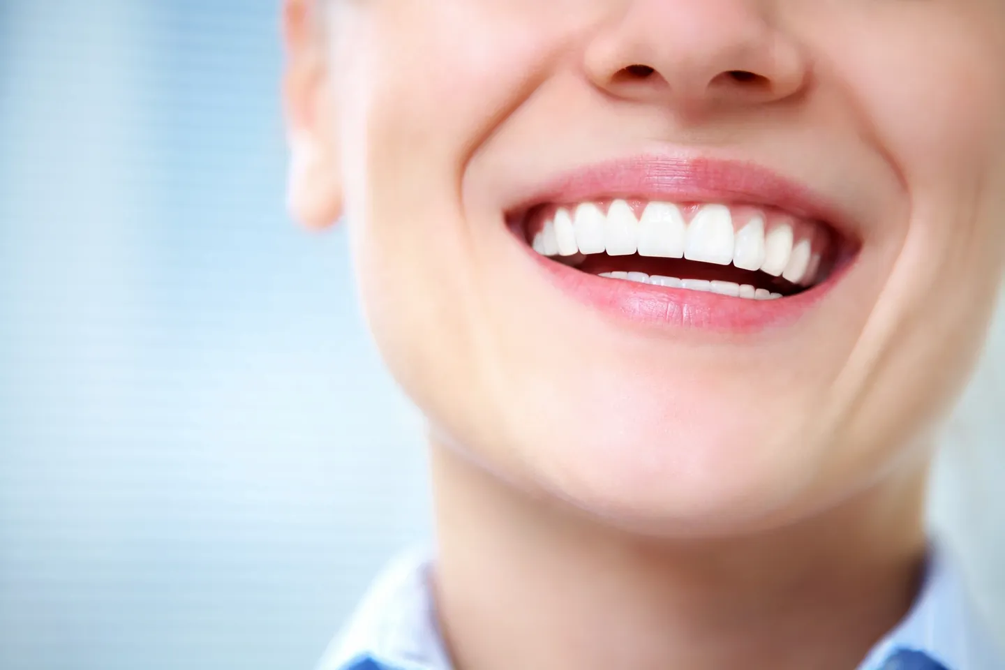 Natural-looking smile enhanced with dental bonding in Calgary