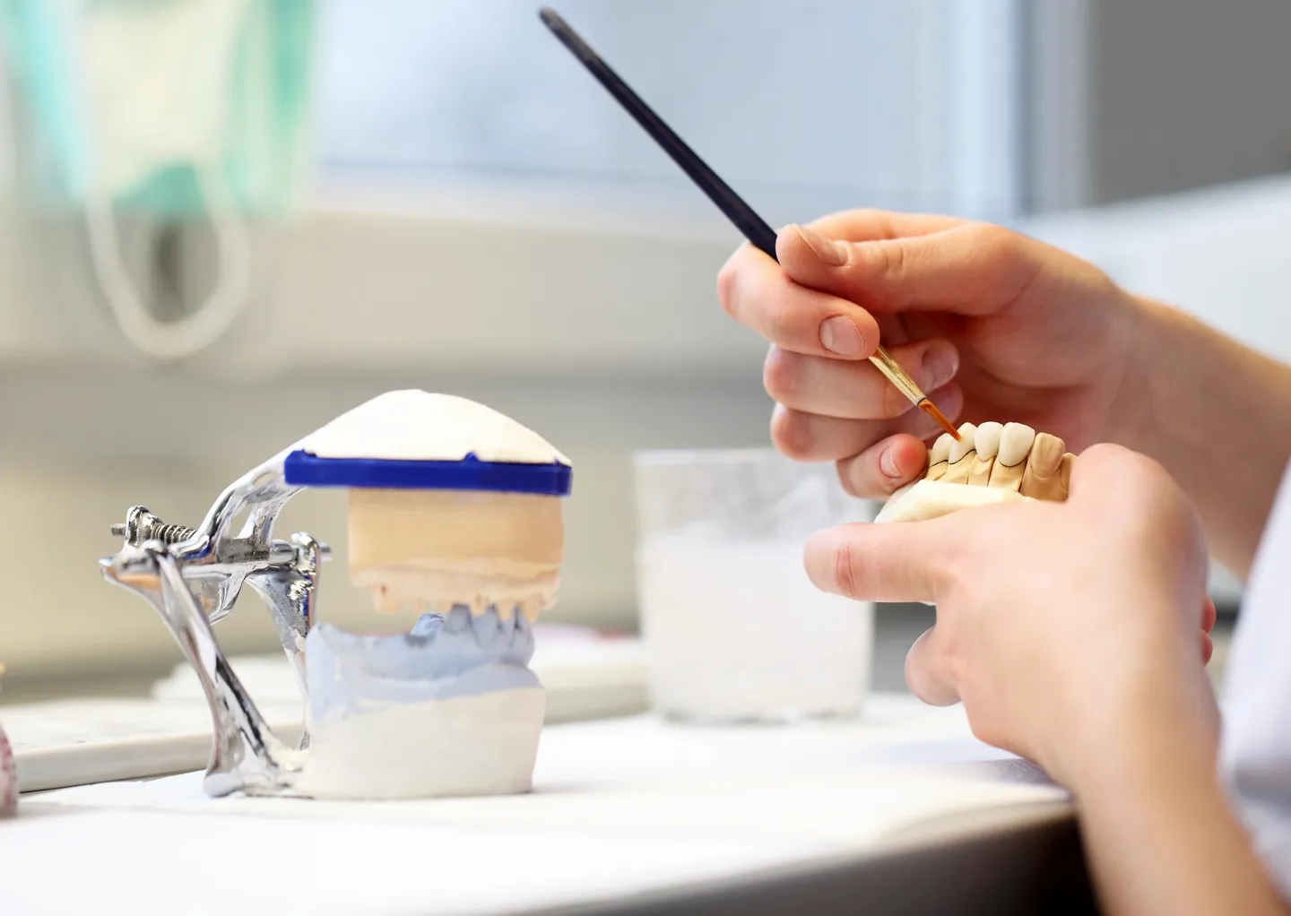 Same-day crown replacement at Tooth Bar in Calgary