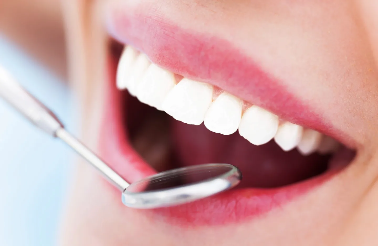 Dental exam for chipped tooth repair in Calgary
