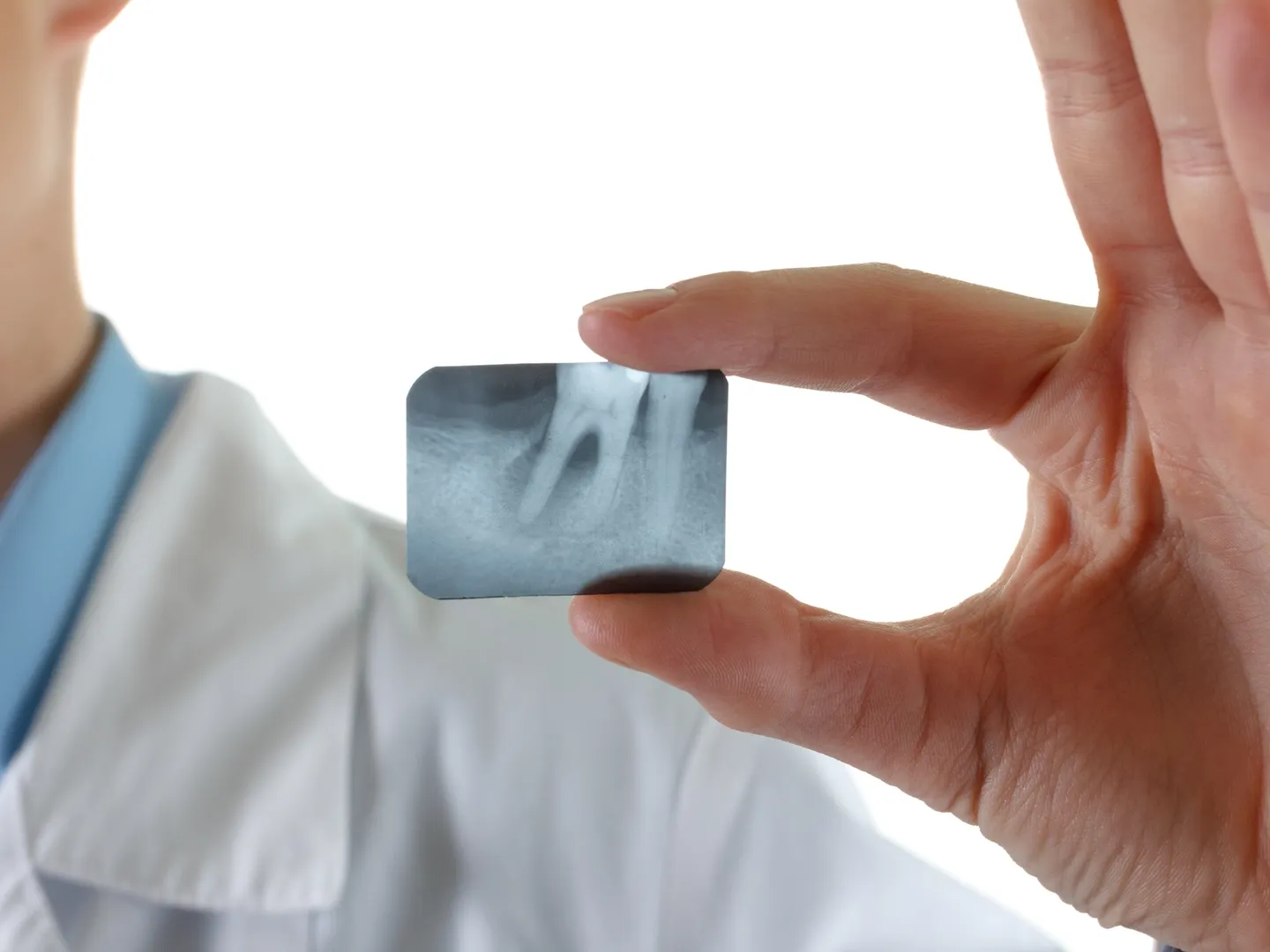 Digital dental x-ray scan for emergency dental care at Tooth Bar Calgary